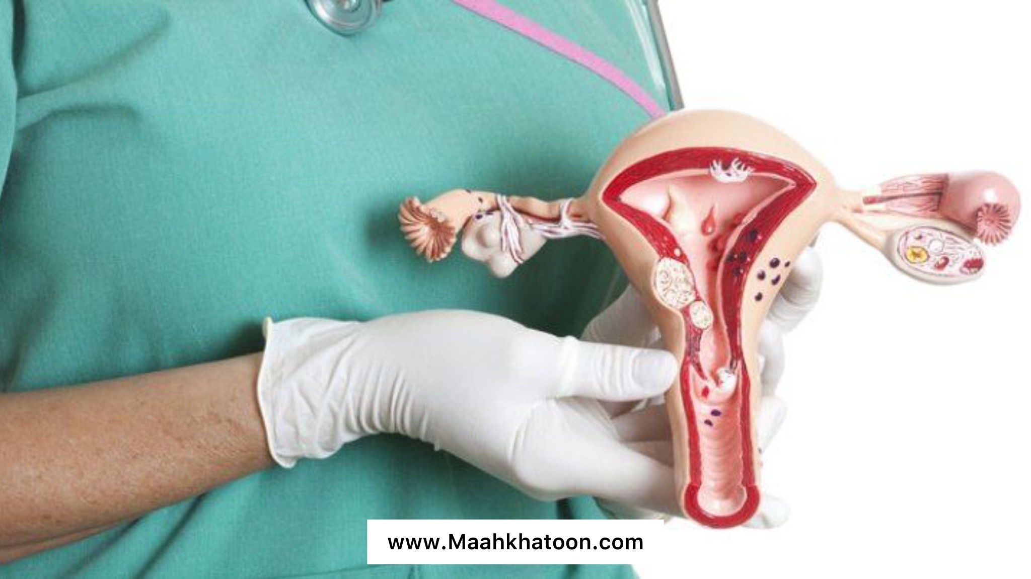 خواص خرفه برای رحم